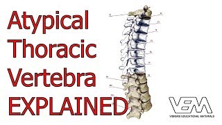 Atypical Thoracic Vertebrae [upl. by Duile]