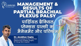 Comprehensive Guide to Partial Plexus Management with Dr Anubhav Gupta [upl. by Sulohcin]