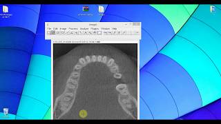 ImageJ amp Volume measurement using Manager ROI [upl. by Yajeet]