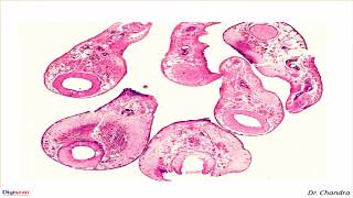 ParasitesGastrodiscoides Hominis  Digipath Tutorialsby Dr M Chandra [upl. by Yvaht]