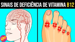 9 Sinais e Sintomas de Deficiência de Vitamina B12 [upl. by Etteval]