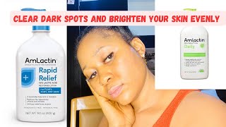 How to Clear dark spots on the body and achieve an Even skin tone with Amlactin body lotion [upl. by Aitnahs]