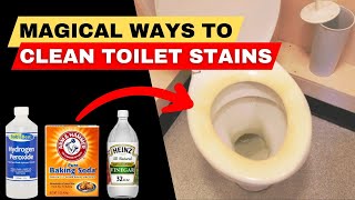 How to Remove Yellow Stains From Toilet Seat Easily [upl. by Enirac]