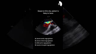 Echocardiography board practice question 13 [upl. by Enileuqaj]