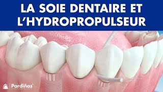 Soie dentaire et l’hydropropulseur — Méthodes de nettoyages des implants © [upl. by Norrie]