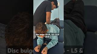 Chiropractic Relief for L3L5 Disc Bulge youngspineclinic [upl. by Ogait]