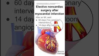 Elective noncardiac surgery after myocardial infarction [upl. by Yelad16]