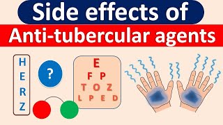 Side effects of AntiTubercular agents in easy way [upl. by Schram]