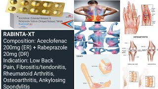 Treatment of low back pain  Fibrositis  Tendinitis  Osteoarthritis  Rheumatoid arthritis [upl. by Philps]