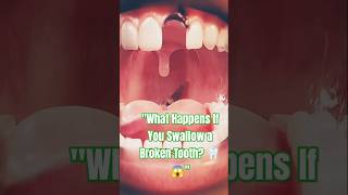 quotWhat Happens If You Swallow a Broken Tooth 🦷😱quot shorts science [upl. by Akkin]