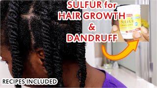 Sulfur for Hair Growth and Dandruff  RECIPES INCLUDED  DiscoveringNatural [upl. by Silberman]