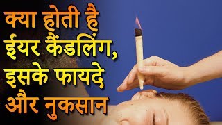 Ear Candling for Wax Removal  क्या होती है ईयर कैंडलिंग  Purvi Beauty amp Fashion [upl. by Ahsieni351]