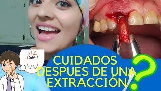 CUIDADOS después de una EXTRACCIÓN DENTAL [upl. by Suedaht]