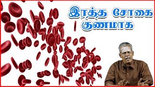 இரத்த சோகை குணமாக  காரணங்கள் அறிகுறிகள் சிகிச்சை முறை  Anemia  Causes Symptoms Treatments [upl. by Schaffel543]