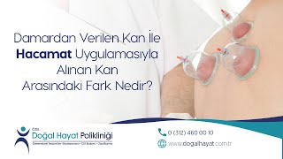 Hacamat Tedavisinin Faydaları Nelerdir [upl. by Ceciley]