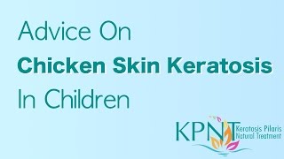 Advice On Chicken Skin Keratosis In Children Video [upl. by Ringe]