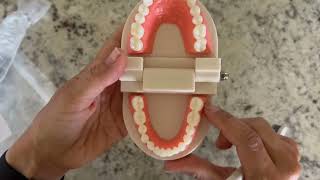 Patelai 2 Pcs Standard Teeth Model Denture Model Teeth Teaching Model Review [upl. by Yddur194]