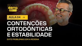 Aula 49  Contenções ortodônticas e estabilidade [upl. by Kenti]