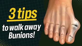 3 Tips for Bunions [upl. by Frodi]