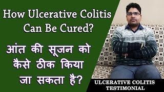 How Ulcerative colitis can be Cured  अल्सरेटिव कोलाइटिस को कैसे ठीक किया जा सकता है [upl. by Odnomyar]