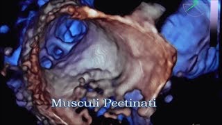 Musculi Pectinati [upl. by Dani]