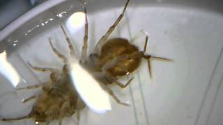 microscope video of asellus aquaticus waterlouse aquatic sowbug  Wasserassel unterm Mikroskop [upl. by Oetsira]