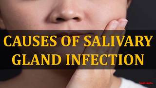 CAUSES OF SALIVARY GLAND INFECTION [upl. by Aseen]