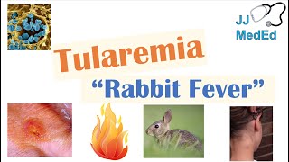 Tularemia Rabbit Fever  Causes Pathogenesis Forms Symptoms Diagnosis Treatment [upl. by Wiley]