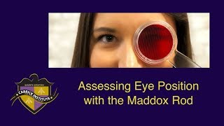 CITV 4  Maddox Rod amp Eye Position Testing [upl. by Anitirhc541]