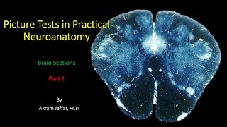 Picture Test in Neuroanatomy Brain Sections 1 [upl. by Ebaj]