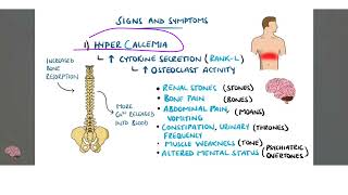 multiple myeloma شرح بالعربي [upl. by Rosemary266]