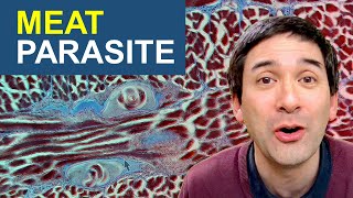 Why I would not eat this meat  Parasite Worms in meat under the microscope [upl. by Trebled]