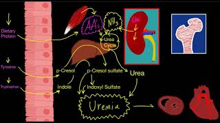 CKD Uremia and dietary protein [upl. by Arukas]