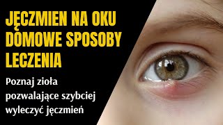 Jęczmień na oku domowe sposoby leczenia [upl. by Kiona]