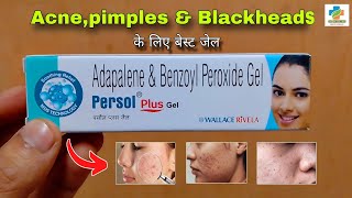 Persol Plus Gel Use in Hindi  Acnepimples Blackhead  Adapalene amp Benzoyl peroxide SK MEDICINE [upl. by Draner]