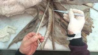 The Neck Ventral dissection [upl. by Siramad80]