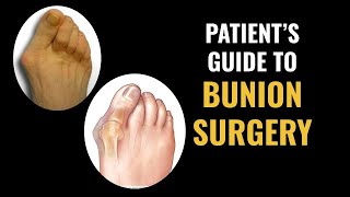 Patients Guide to Bunion Surgery [upl. by Ramraj]