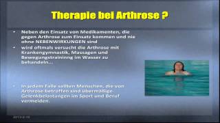 Hausmittel gegen Arthrose [upl. by Carberry297]