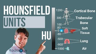 Hounsfield Units Where do CT numbers come from [upl. by Eryn301]