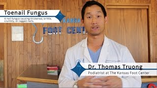 How to Get Rid of Toenail Fungus Effectively [upl. by Mariquilla764]