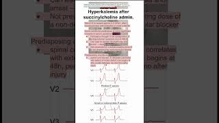 Hyperkalemia after succinylcholine admin [upl. by Aigneis]