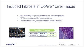 Webinar Modeling NAFLD and TGFbetainduced Fibrosis in ExVive™ Human Liver Tissue [upl. by Nami]