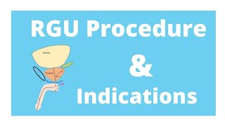 RGU procedure amp its indication [upl. by Maisie]