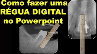 Digitalização de Radiografias  Parte 3 [upl. by Gittel881]