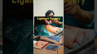 Ligament Surgery kis age group ko jyada jarurat hoti hai dailytips health doctor viralvideo [upl. by Aneela]