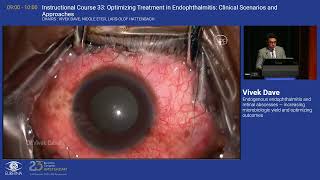 5 Endogenous endophthalmitis and retinal abscesses — increasing microbiologic yield and [upl. by Junko]