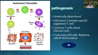 Hashimotos Thyroiditis amp Graves disease  Endocrine  RATS in Pathology  Dr G Shivashekar [upl. by Howarth]