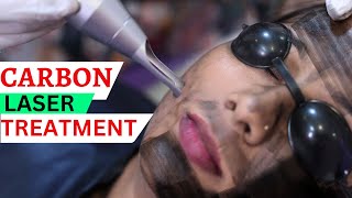 Pico Laser Treatment For Acne Scars And pigmentation  sparsh skin lasers acnescars [upl. by Norvol226]