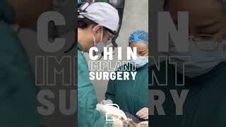 Chin augmentation goes beyond simple enhancement—it can also refine the lower third of the face [upl. by Sidoeht722]