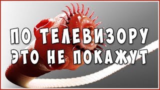 Паразиты Глисты Гельминты Черви в организме человека Последствия Защита Лечение [upl. by Redienhcs]